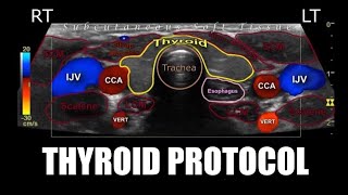 Sonoquickies  Thyroid Ultrasound Protocol [upl. by Freytag968]