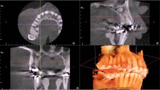 Oral Radiologists Cone Beam CT Interpretation 1 [upl. by Gleich584]