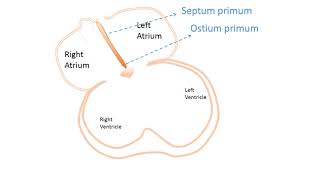 interatrial Septum development [upl. by Hplodnar100]