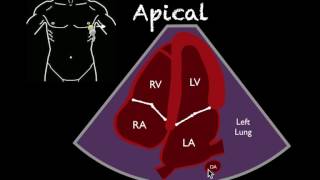 Bedside Ultrasound Basic Cardiac US [upl. by Kenelm]