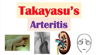 Takayasu’s Arteritis Pulseless Disease  Large Vessel Vasculitis Symptoms Diagnosis Treatment [upl. by Rodolph842]