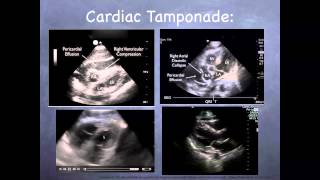 Tutorial Basic echocardiography [upl. by Meridith]