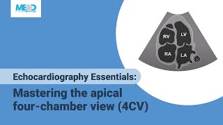 Echocardiography Essentials Mastering the apical fourchamber view 4CV [upl. by Old]