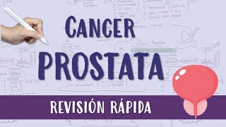 CANCER DE PROSTATA FÁCIL [upl. by Bechler]