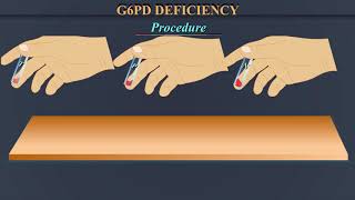 G6PD Deficiency [upl. by Heady911]