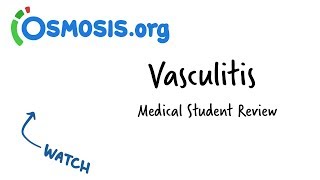 Vasculitis  Clinical Presentation [upl. by Riti]