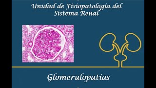 Glomerulopatías [upl. by Naerad3]