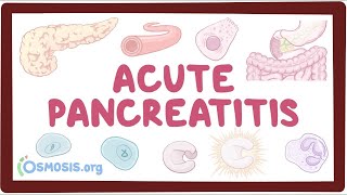 Acute pancreatitis  an Osmosis Preview [upl. by Hindorff264]