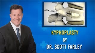 What is involved with a Kyphoplasty procedure [upl. by Yzmar]