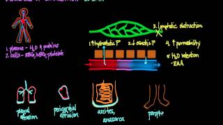 Disorders of Circulation Edema [upl. by Alexio467]