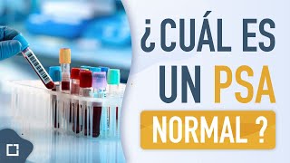 Próstata inflamada o grande ¿cual es un PSA NORMAL [upl. by Olonam]