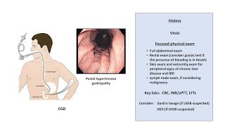 An Approach to GI Bleeding Melena Hematemesis Hematochezia [upl. by Bowrah722]