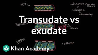 Transudate vs exudate  Respiratory system diseases  NCLEXRN  Khan Academy [upl. by Vani973]