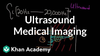 Ultrasound medical imaging  Mechanical waves and sound  Physics  Khan Academy [upl. by Fabrice]