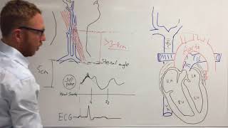 Jugular venous pressure [upl. by Niwri]